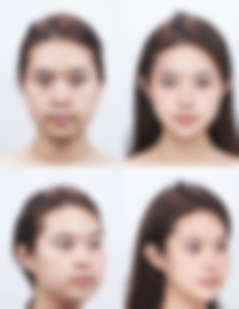 榆林朝阳医院整形美容科患者常见问题解答