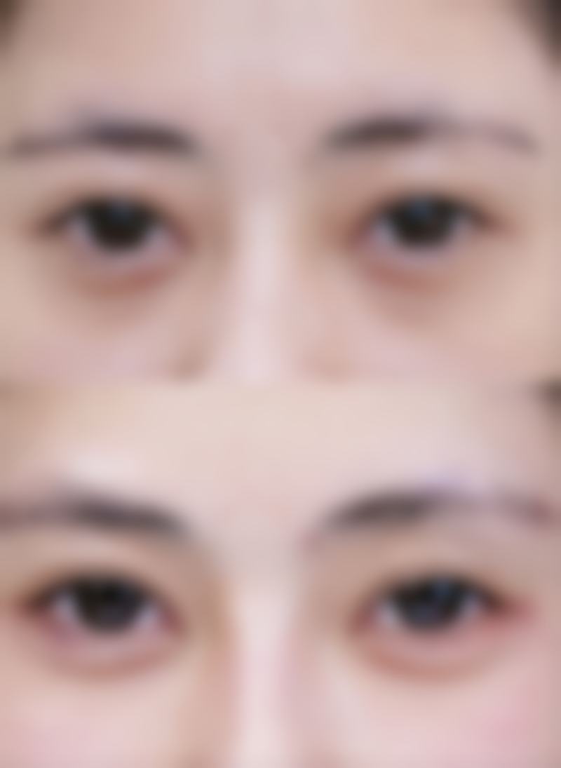 榆林朝阳医院整形美容科医院特色技术及优质服务