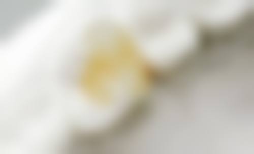 玻璃离子水门汀：释氟防龋但强度有限