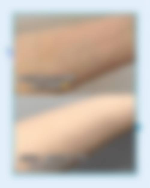 广州唯臻医学美容门诊部详细的预约挂号方式及流程