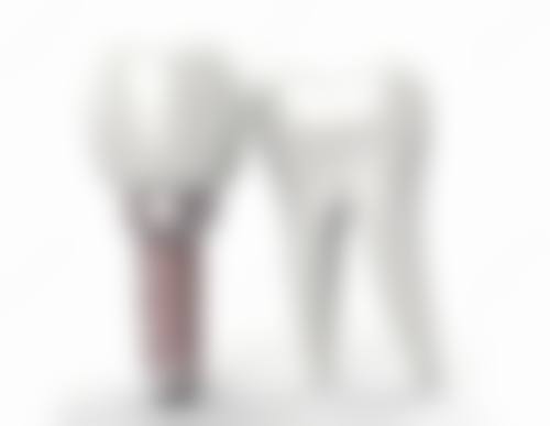 总结深圳格伦菲尔口腔收费优势