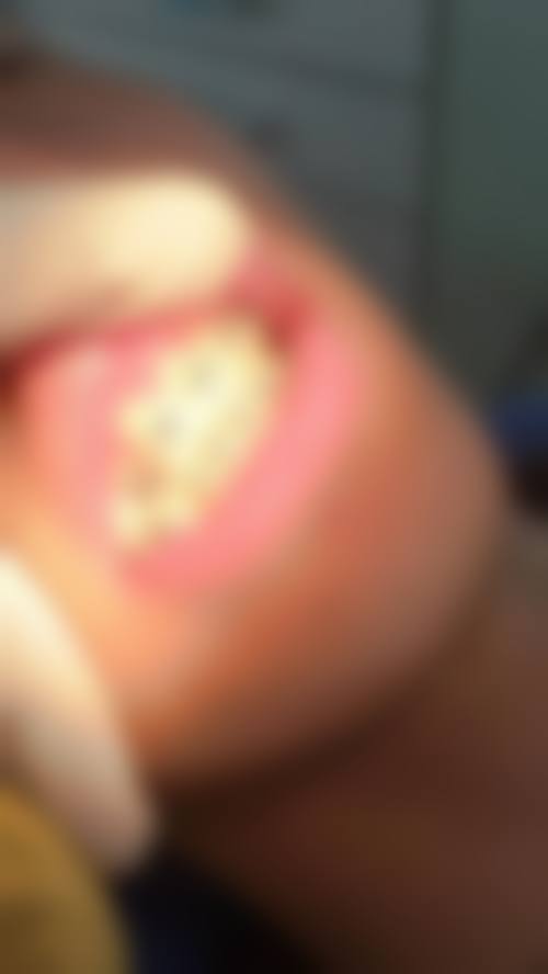 {山西金属矫正在线咨询24小时，免费解答正畸疑惑，推荐专业医生还能预估费用