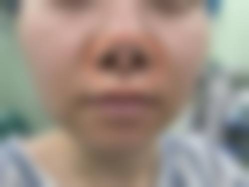 沈阳城本整形医院价目表