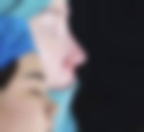 韩国Merry整形外科特色项目及技术优势