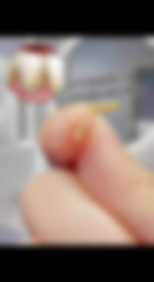 早期发现疾病：口腔健康的“侦察兵”