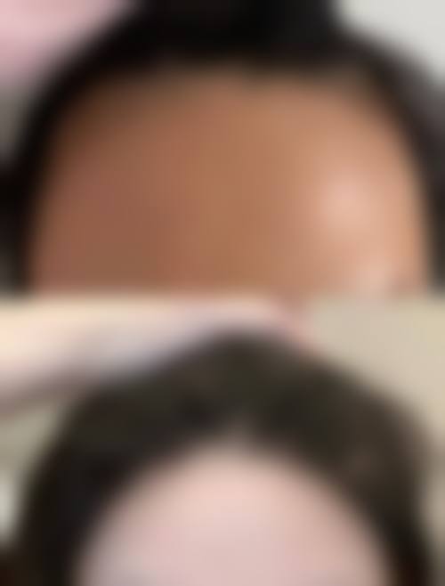 贵阳新生植发医院怎么样？