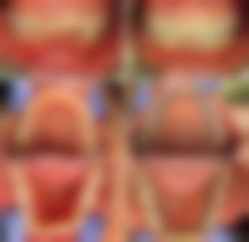 牙齿美白治疗方法