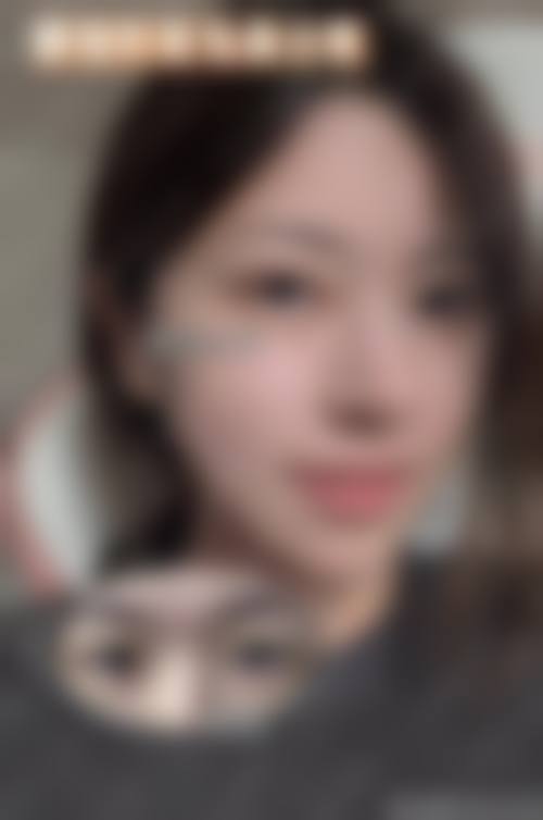 西安柒悦整形医院真实实例