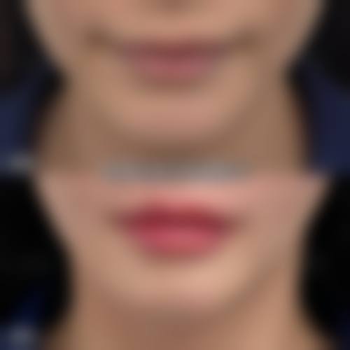 焦作理想俪人医疗美容诊所收费价格表/收费标准