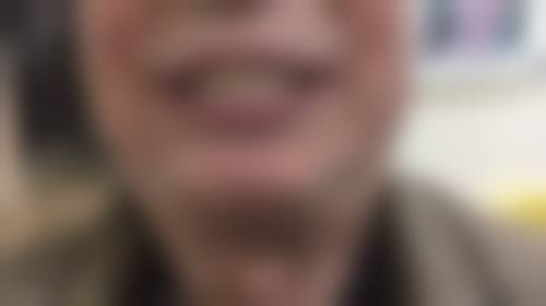 中诺立得用种牙方案优势