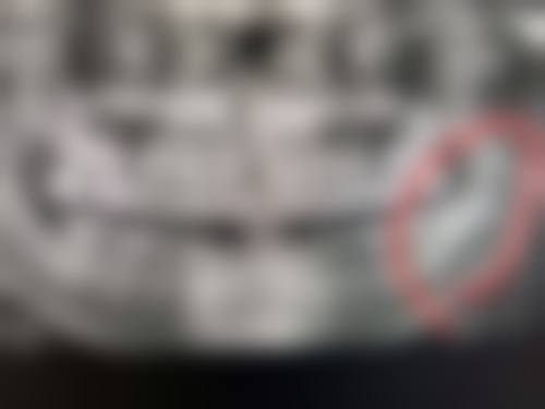 拔牙前后的注意事项大集合