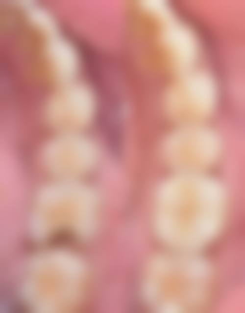 {沈阳德立联合口腔医院地址：铁西区建设中路30号9门，交通便捷种牙2580元起矫正6800元起