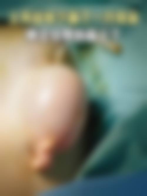 清远华美整形门诊部擅长项目