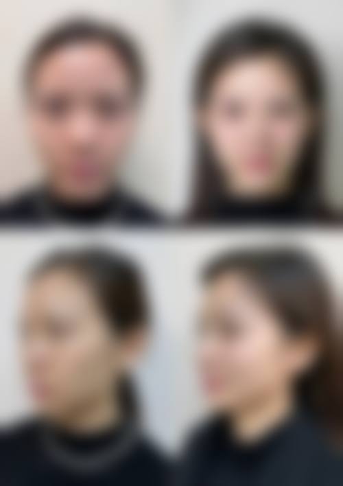 清远华美整形门诊部价格表