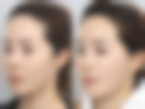 清远华美整形门诊部医生名单及擅长领域