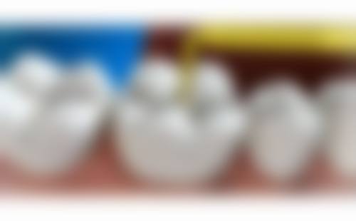 孝感补牙医院在线咨询24小时，市中心医院、第一医院、乾坤阳光任你选