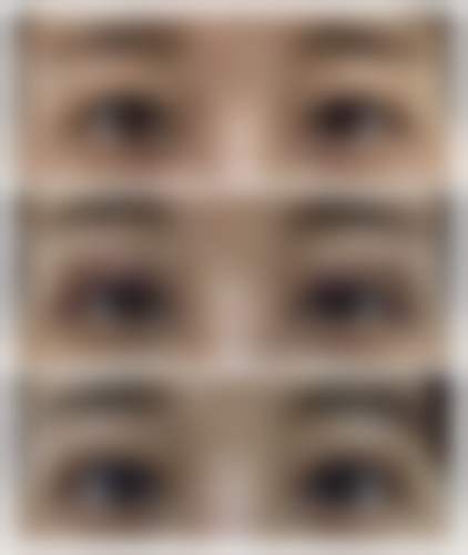 韩国爱特乐皮肤整容外科特色项目及技术优势