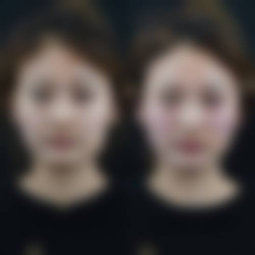 上海爱慕整形门诊部口碑如何？