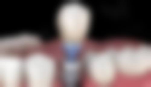 兰州海涛口腔医院患者评价