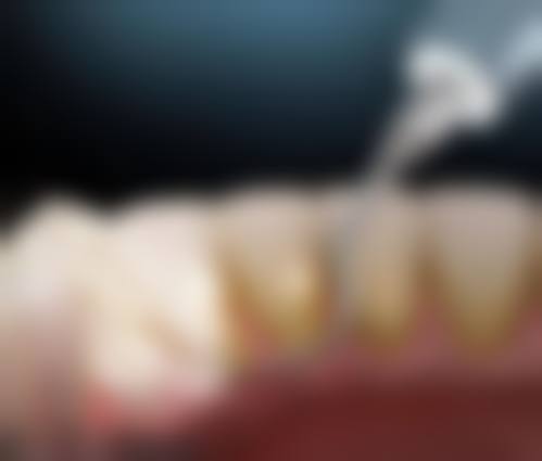 大型医院：牙周科——专注牙周健康的洗牙补牙之选