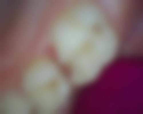 六、各口腔科的特色项目有哪些？