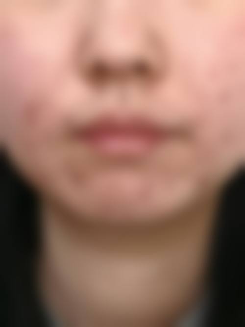 韩国爱特乐皮肤整容外科详细的预约挂号方式及流程