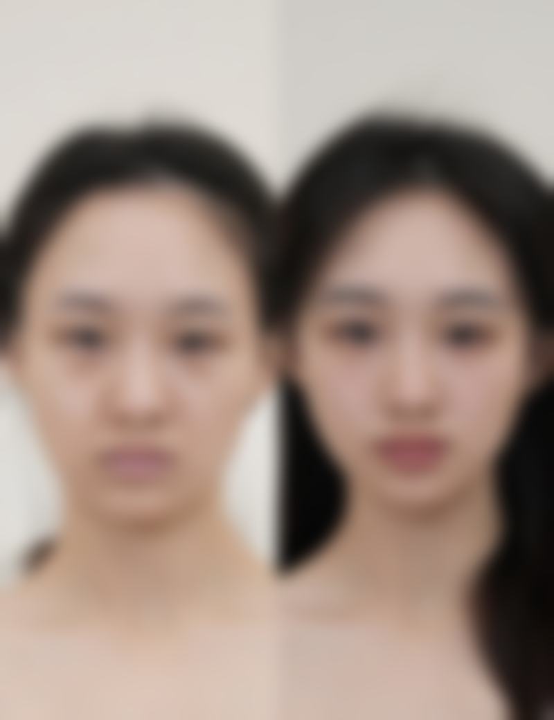 上海爱慕整形门诊部正规可靠吗？