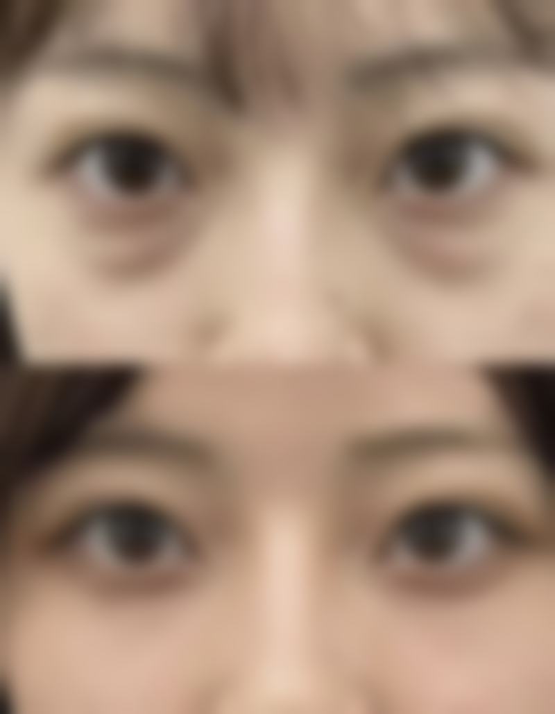 韩国爱特乐皮肤整容外科真人口碑评价怎么样？