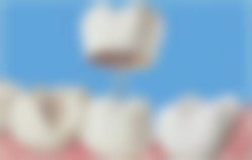 价格对比：泽康贵有贵的道理，威兰德性价比高