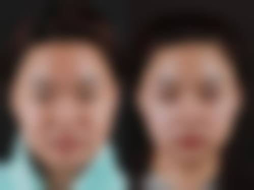 牡丹江市回民医院整形科口碑评价