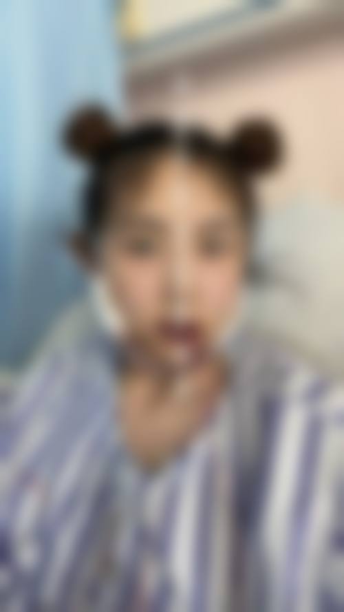 口腔习惯问题：不良习惯扰乱牙齿生长