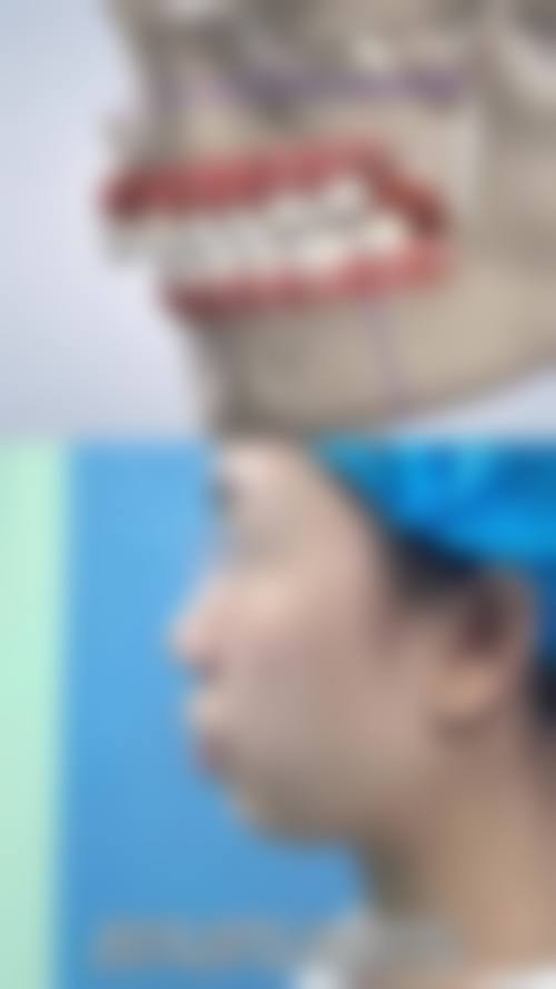 喂养姿势不当：错误喂养引发牙齿问题