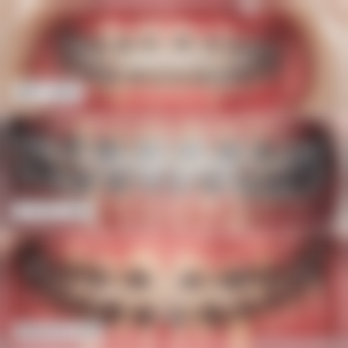 汉中小虎牙收费标准