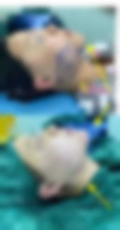 牡丹江市回民医院整形科预约挂号方式