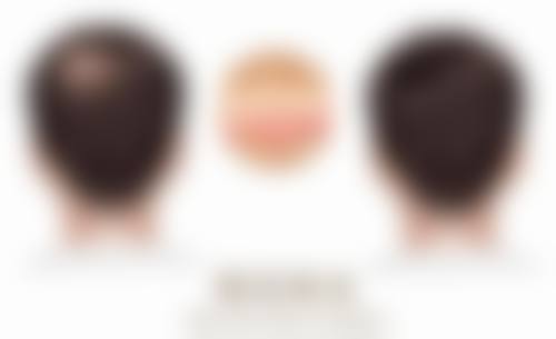 郑州张朝蕾医疗美容医院真人口碑评价怎么样？