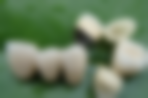 根管治疗与打桩的关系总结