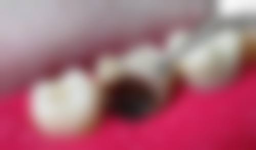 何种情况需要打桩？