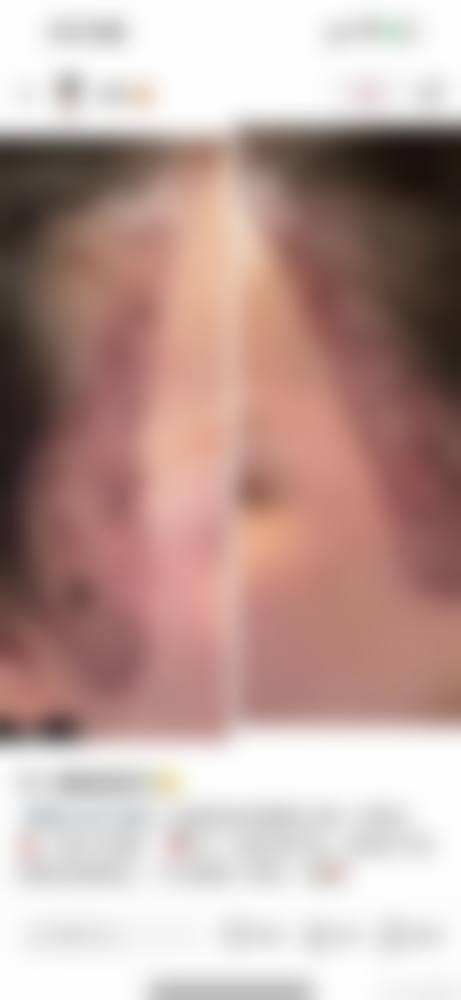 青岛熙朵植发连锁预约方式