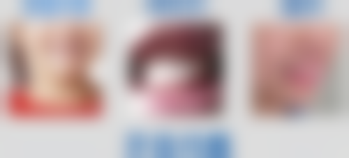 纠正不良习惯，阻断地包天发展