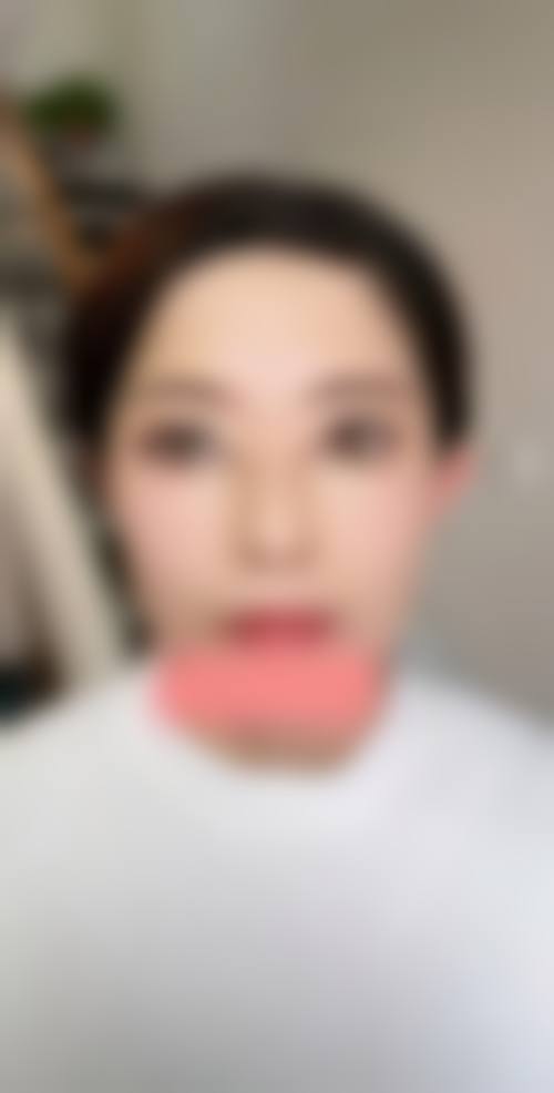 扬州艺星美医疗美容医院重点项目解析