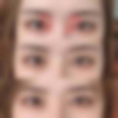 扬州艺星美医疗美容医院真实体验