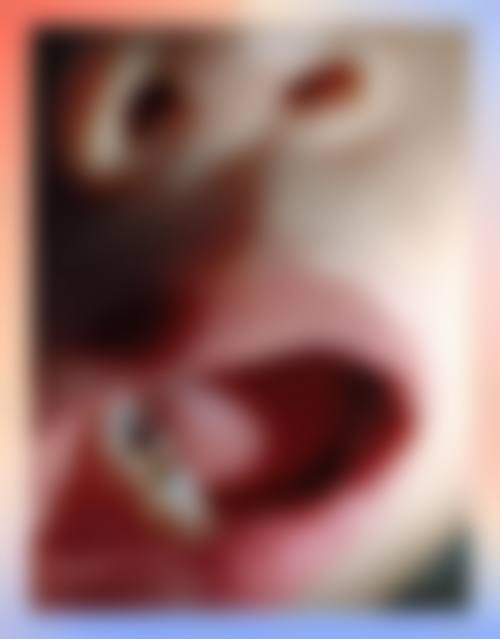 牙结石：洗牙击碎顽固“黑卫士”