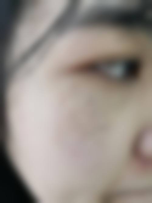 三明欧菲医疗美容门诊部实力解析：诊疗、设备、口碑三维度展示