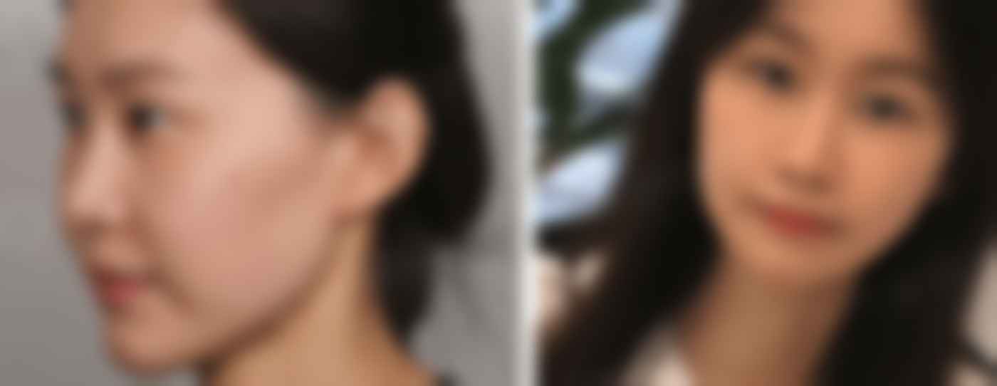 窦守峰医生口碑评价及真人实例