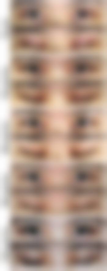 南充尚美医疗美容诊所收费贵吗？