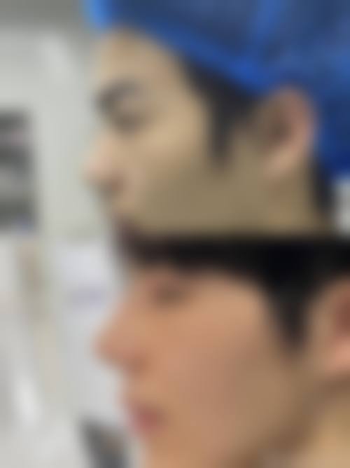 临沂欧美医疗整形美容诊所收费标准