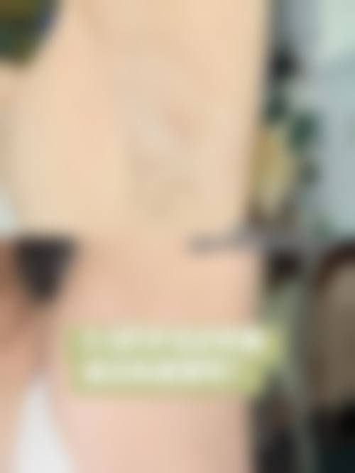 临沂欧美医疗整形美容诊所口碑怎么样？