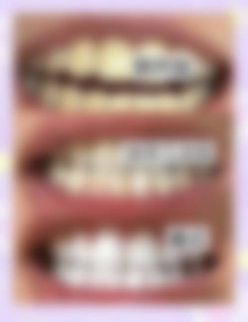 西安交大口腔医院基础治疗及其他项目收费