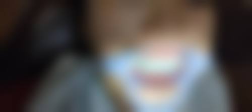 西安交大口腔医院镶牙项目选择