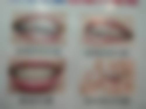 在线询问：便捷获取专精建议